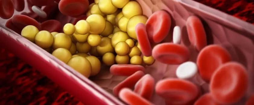 Jakie leki na obniżenie trójglicerydów skutecznie pomogą Ci?